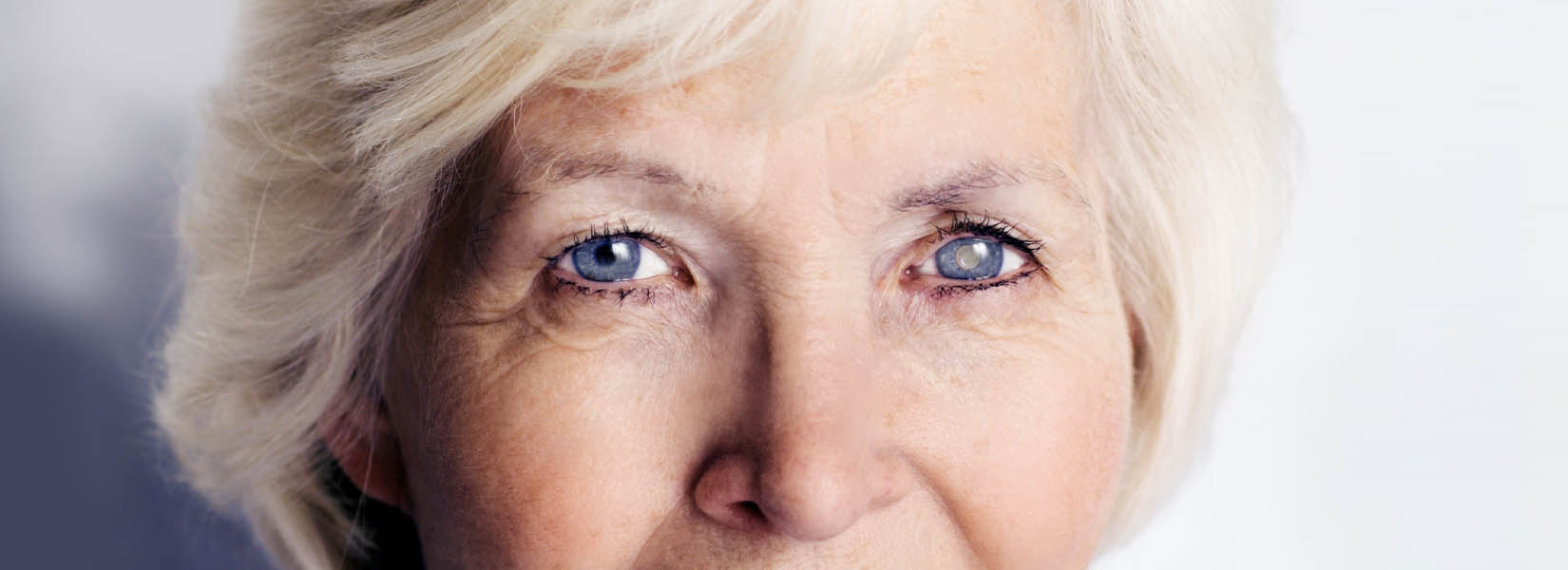Cataract Surgery in First Colony Commons